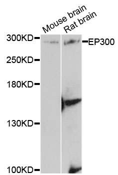 EP300 / p300 Antibody - Western blot analysis of extracts of various cell lines, using EP300 antibody at 1:3000 dilution. The secondary antibody used was an HRP Goat Anti-Rabbit IgG (H+L) at 1:10000 dilution. Lysates were loaded 25ug per lane and 3% nonfat dry milk in TBST was used for blocking. An ECL Kit was used for detection and the exposure time was 90s.