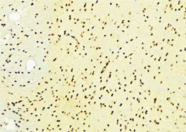 EP300 / p300 Antibody - 1:100 staining mouse brain tissue by IHC-P. The sample was formaldehyde fixed and a heat mediated antigen retrieval step in citrate buffer was performed. The sample was then blocked and incubated with the antibody for 1.5 hours at 22°C. An HRP conjugated goat anti-rabbit antibody was used as the secondary.