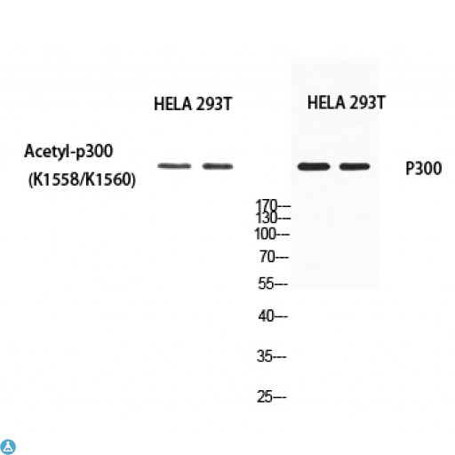 EP300 / p300 Antibody - Western Blot (WB) analysis of HeLa 293T using Acetyl-p300 (K1558/K1560) antibody.