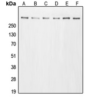 EP300 / p300 Antibody - Western blot analysis of p300 expression in A431 (A); HeLa (B); HT29 (C); A549 (D); NIH3T3 (E); PC12 (F) whole cell lysates.