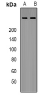 EP300 / p300 Antibody - Western blot analysis of p300 expression in HeLa (A); HEK293T (B) whole cell lysates.