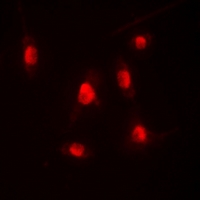 EP300 / p300 Antibody - Immunofluorescent analysis of p300 staining in HEK293T cells. Formalin-fixed cells were permeabilized with 0.1% Triton X-100 in TBS for 5-10 minutes and blocked with 3% BSA-PBS for 30 minutes at room temperature. Cells were probed with the primary antibody in 3% BSA-PBS and incubated overnight at 4 deg C in a humidified chamber. Cells were washed with PBST and incubated with a DyLight 594-conjugated secondary antibody (red) in PBS at room temperature in the dark. DAPI was used to stain the cell nuclei (blue).