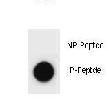 EP300 / p300 Antibody - Dot blot of EP300 Antibody (Phospho S1834) Phospho-specific antibody on nitrocellulose membrane. 50ng of Phospho-peptide or Non Phospho-peptide per dot were adsorbed. Antibody working concentrations are 0.6ug per ml.