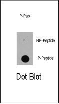 EP300 / p300 Antibody - Dot blot of anti-Phospho-EP300-S89 antibody on nitrocellulose membrane. 50ng of Phospho-peptide (BP3197a) or Non Phospho-peptide per dot were adsorbed. Antibodies working concentration was 0.5ug per ml.