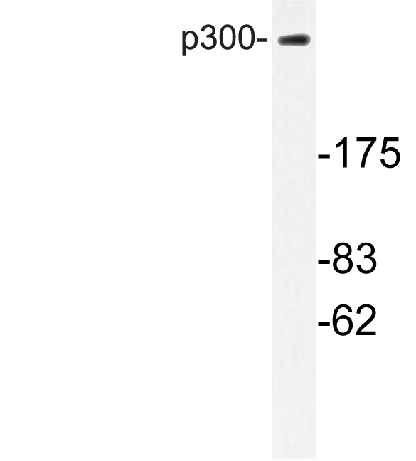 EP300 / p300 Antibody - Western blot of p300 (V6) pAb in extracts from MDA-MB-435 cells.