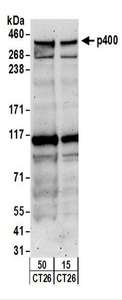 EP400 / p400 Antibody - Detection of Mouse p400 by Western Blot. Samples: Whole cell lysate from CT26.WT (15 and 50 ug) cells. Antibodies: Affinity purified rabbit anti-p400 antibody used for WB at 0.2 ug/ml. Detection: Chemiluminescence with an exposure time of 3 minutes.