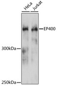 EP400 / p400 Antibody - Western blot analysis of extracts of various cell lines, using EP400 antibody at 1:3000 dilution. The secondary antibody used was an HRP Goat Anti-Rabbit IgG (H+L) at 1:10000 dilution. Lysates were loaded 25ug per lane and 3% nonfat dry milk in TBST was used for blocking. An ECL Kit was used for detection and the exposure time was 90s.