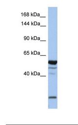 EPB41L2 Antibody - MCF7 cell lysate. Antibody concentration: 1.0 ug/ml. Gel concentration: 6-18%.  This image was taken for the unconjugated form of this product. Other forms have not been tested.