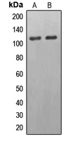 EPB41L2 Antibody - Western blot analysis of EPB41L2 expression in HeLa (A); HepG2 (B) whole cell lysates.