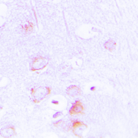 EPB41L2 Antibody - Immunohistochemical analysis of EPB41L2 staining in human brain formalin fixed paraffin embedded tissue section. The section was pre-treated using heat mediated antigen retrieval with sodium citrate buffer (pH 6.0). The section was then incubated with the antibody at room temperature and detected using an HRP conjugated compact polymer system. DAB was used as the chromogen. The section was then counterstained with hematoxylin and mounted with DPX.
