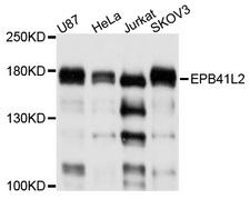 EPB41L2 Antibody - Western blot analysis of extracts of various cell lines.