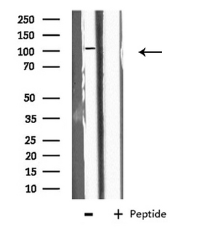 EPB41L2 Antibody - Western blot analysis of extracts of K562 cells using EPB41L2 antibody.