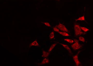 EPB41L2 Antibody - Staining HeLa cells by IF/ICC. The samples were fixed with PFA and permeabilized in 0.1% Triton X-100, then blocked in 10% serum for 45 min at 25°C. The primary antibody was diluted at 1:200 and incubated with the sample for 1 hour at 37°C. An Alexa Fluor 594 conjugated goat anti-rabbit IgG (H+L) antibody, diluted at 1/600, was used as secondary antibody.
