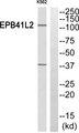 EPB41L2 Antibody - Western blot analysis of extracts from K562 cells, using EPB41L2 antibody.