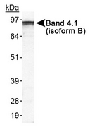 EPB41L3 Antibody - Detection of Band 4.1 in HeLa whole cell lysate.  This image was taken for the unconjugated form of this product. Other forms have not been tested.