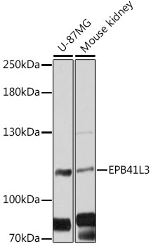 EPB41L3 Antibody - Western blot analysis of extracts of various cell lines, using EPB41L3 antibody at 1:3000 dilution. The secondary antibody used was an HRP Goat Anti-Rabbit IgG (H+L) at 1:10000 dilution. Lysates were loaded 25ug per lane and 3% nonfat dry milk in TBST was used for blocking. An ECL Kit was used for detection and the exposure time was 30s.