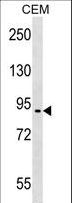 EPB41L4A Antibody - EPB41L4A Antibody western blot of CEM cell line lysates (35 ug/lane). The EPB41L4A antibody detected the EPB41L4A protein (arrow).