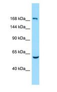 EPB41L4B Antibody - EPB41L4B antibody Western Blot of Fetal Lung.  This image was taken for the unconjugated form of this product. Other forms have not been tested.