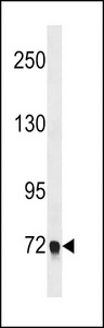 EPB41L5 Antibody - EPB41L5 Antibody western blot of A549 cell line lysates (35 ug/lane). The EPB41L5 antibody detected the EPB41L5 protein (arrow).