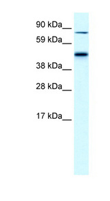 EPB42 Antibody - EPB42 / Pallidin antibody Western blot of Fetal liver lysate. This image was taken for the unconjugated form of this product. Other forms have not been tested.