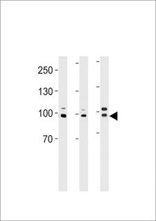 EPC1 Antibody - EPC1 Antibody western blot of A2058,HeLa cell line and mouse heart tissue lysates (35 ug/lane). The EPC1 antibody detected the EPC1 protein (arrow).