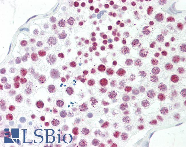 EPC1 Antibody - Anti-EPC1 antibody IHC staining of human testis. Immunohistochemistry of formalin-fixed, paraffin-embedded tissue after heat-induced antigen retrieval. Antibody concentration 20 ug/ml.  This image was taken for the unconjugated form of this product. Other forms have not been tested.