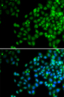 EPC1 Antibody - Immunofluorescence analysis of HeLa cells.