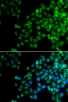 EPC1 Antibody - Immunofluorescence analysis of HeLa cells.