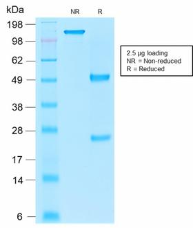 EPCAM Antibody - SDS-PAGE Analysis Purified EpCAM Mouse Recombinant Monoclonal Antibody (rEGP40/1110). Confirmation of Purity and Integrity of Antibody.