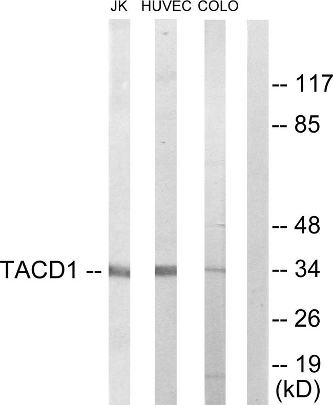 EPCAM Antibody - Western blot analysis of lysates from Jurkat, HUVEC, and COLO205 cells, using TACD1 Antibody. The lane on the right is blocked with the synthesized peptide.