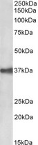 EPCAM Antibody - EPCAM antibody (0.03 ug/ml) staining of CACO-2 lysate (35 ug protein in RIPA buffer). Primary incubation was 1 hour. Detected by chemiluminescence.