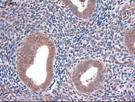 EPCAM Antibody - IHC of paraffin-embedded Human endometrium tissue using anti-TACSTD1 mouse monoclonal antibody.