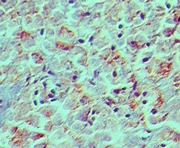 EPCAM Antibody - IHC of EpCAM in human pancreas using EpCAM antibody at 5 ug/ml.