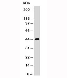 EPCAM Antibody - Western blot testing of HCT116 cell lysate and EpCAM antibody (EPM17-1).  This image was taken for the unmodified form of this product. Other forms have not been tested.