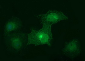 EPCAM Antibody - Anti-EPCAM mouse monoclonal antibody immunofluorescent staining of COS7 cells transiently transfected by pCMV6-ENTRY EPCAM.
