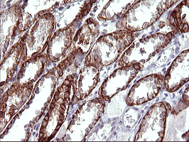 EPCAM Antibody - IHC of paraffin-embedded Human Kidney tissue using anti-EPCAM mouse monoclonal antibody. (Heat-induced epitope retrieval by 10mM citric buffer, pH6.0, 120°C for 3min).