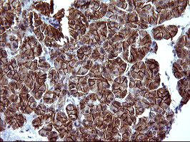 EPCAM Antibody - IHC of paraffin-embedded Human pancreas tissue using anti-EPCAM mouse monoclonal antibody. (Heat-induced epitope retrieval by 10mM citric buffer, pH6.0, 120°C for 3min).