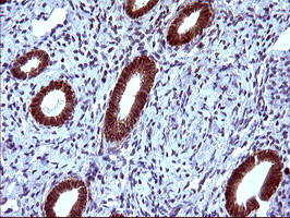 EPCAM Antibody - IHC of paraffin-embedded Human endometrium tissue using anti-EPCAM mouse monoclonal antibody. (Heat-induced epitope retrieval by 10mM citric buffer, pH6.0, 120°C for 3min).