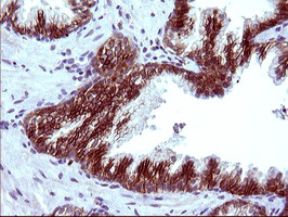 EPCAM Antibody - IHC of paraffin-embedded Human prostate tissue using anti-EPCAM mouse monoclonal antibody. (Heat-induced epitope retrieval by 10mM citric buffer, pH6.0, 120°C for 3min).