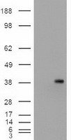 EPCAM Antibody - HEK293T cells were transfected with the pCMV6-ENTRY control (Left lane) or pCMV6-ENTRY EpCAM (Right lane) cDNA for 48 hrs and lysed. Equivalent amounts of cell lysates (5 ug per lane) were separated by SDS-PAGE and immunoblotted with anti-EpCAM.