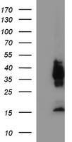 EPCAM Antibody - HEK293T cells were transfected with the pCMV6-ENTRY control (Left lane) or pCMV6-ENTRY EPCAM (Right lane) cDNA for 48 hrs and lysed. Equivalent amounts of cell lysates (5 ug per lane) were separated by SDS-PAGE and immunoblotted with anti-EPCAM.