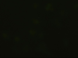 EPCAM Antibody - Immunofluorescent staining of HeLa cells using anti-EpCAM mouse monoclonal antibody.