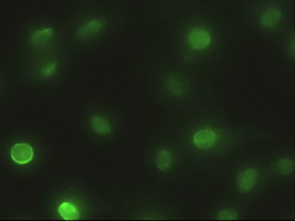 EPCAM Antibody - Anti-EpCAM mouse monoclonal antibody  immunofluorescent staining of HeLa cells transiently transfected by pCMV6-ENTRY EpCAM.