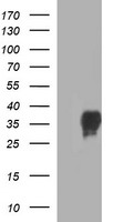 EPCAM Antibody - HEK293T cells were transfected with the pCMV6-ENTRY control (Left lane) or pCMV6-ENTRY EPCAM (Right lane) cDNA for 48 hrs and lysed. Equivalent amounts of cell lysates (5 ug per lane) were separated by SDS-PAGE and immunoblotted with anti-EPCAM.