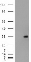 EPCAM Antibody - HEK293T cells were transfected with the pCMV6-ENTRY control (Left lane) or pCMV6-ENTRY EpCAM (Right lane) cDNA for 48 hrs and lysed. Equivalent amounts of cell lysates (5 ug per lane) were separated by SDS-PAGE and immunoblotted with anti-EpCAM.