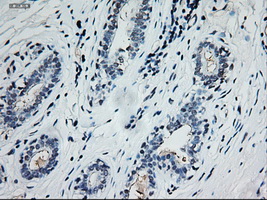 EPCAM Antibody - IHC of paraffin-embedded breast using anti-EpCAM mouse monoclonal antibody.