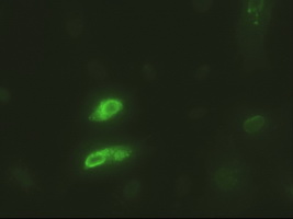 EPCAM Antibody - Anti-EpCAM mouse monoclonal antibody  immunofluorescent staining of HeLa cells transiently transfected by pCMV6-ENTRY EpCAM.