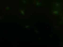 EPCAM Antibody - Immunofluorescent staining of HeLa cells using anti-EpCAM mouse monoclonal antibody.