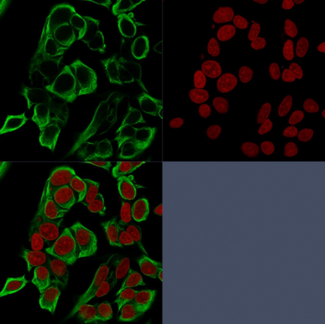 EPCAM Antibody - Confocal immunofluorescence analysis of MCF-7 cells using EpCAM Mouse Recombinant Monoclonal Antibody (rMOC-31) labeled in Green. Reddot is used to label the nucleus red.
