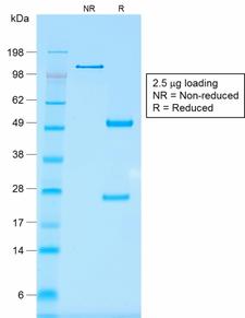 EPCAM Antibody - SDS-PAGE Analysis Purified EpCAM Mouse Recombinant Monoclonal Antibody (rMOC-31). Confirmation of Purity and Integrity of Antibody.